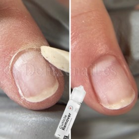 Removedor de cutícula con urea y vitaminas NAILSOFTHEDAY, 60 ml