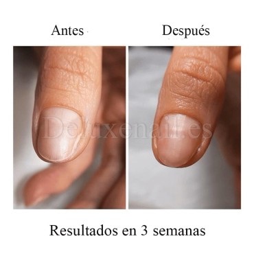 Onistop Podology+ NAILSOFTHEDAY, Tratamiento para prevenir y curar el hongo y la onicólisis de las uñas, 8 ml