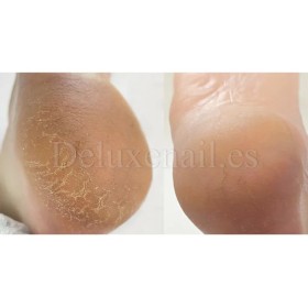 Crema con urea para grietas de talones y manos Podology+ NAILSOFTHEDAY, 30 ml