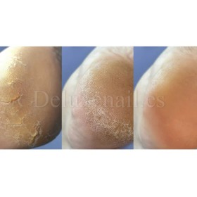 Crema con urea para grietas de talones y manos Podology+ NAILSOFTHEDAY, 30 ml