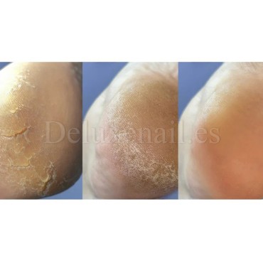 Crema con urea para grietas de talones y manos Podology+ NAILSOFTHEDAY, 30 ml