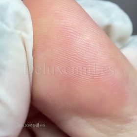 Aceite Regenerador para la piel Staleks, treat.s, 50 ml